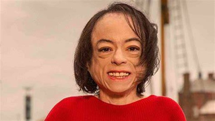 Liz Carr