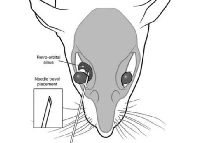 What is a retro-orbital injection?